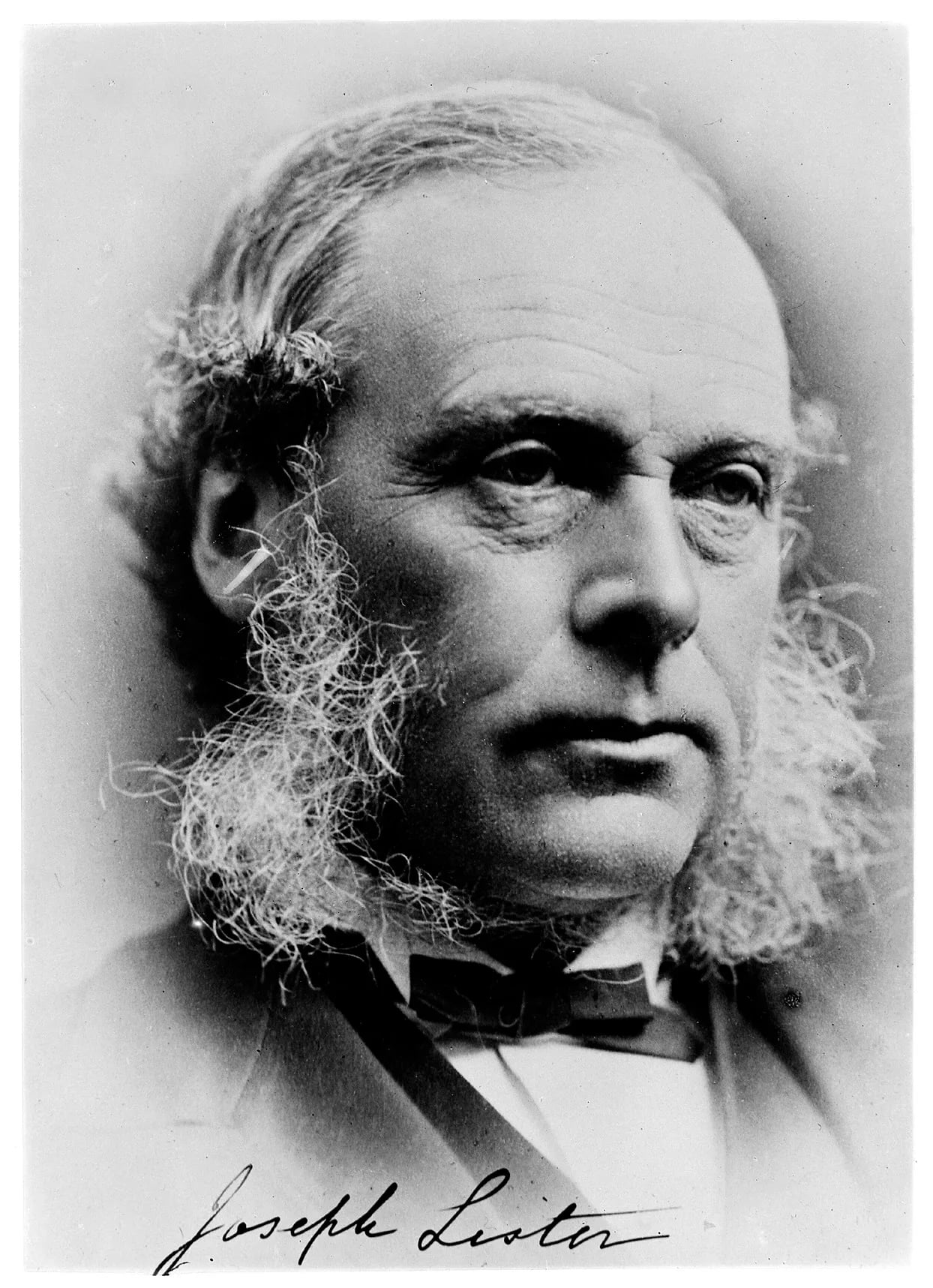 Porträt von Joseph Lister, 1. Baron Lister (1827–1912) – Gedenkseite