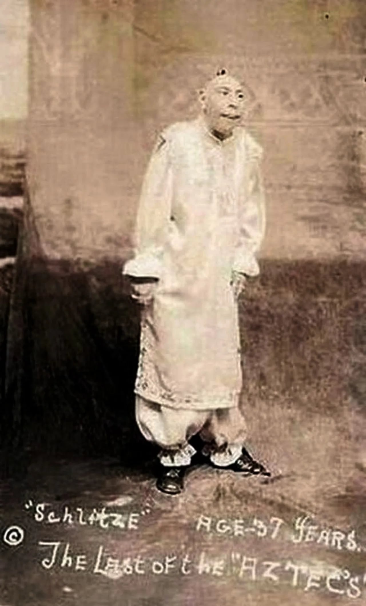 Portrait of Schlitzie (1901–1971) – memorial page