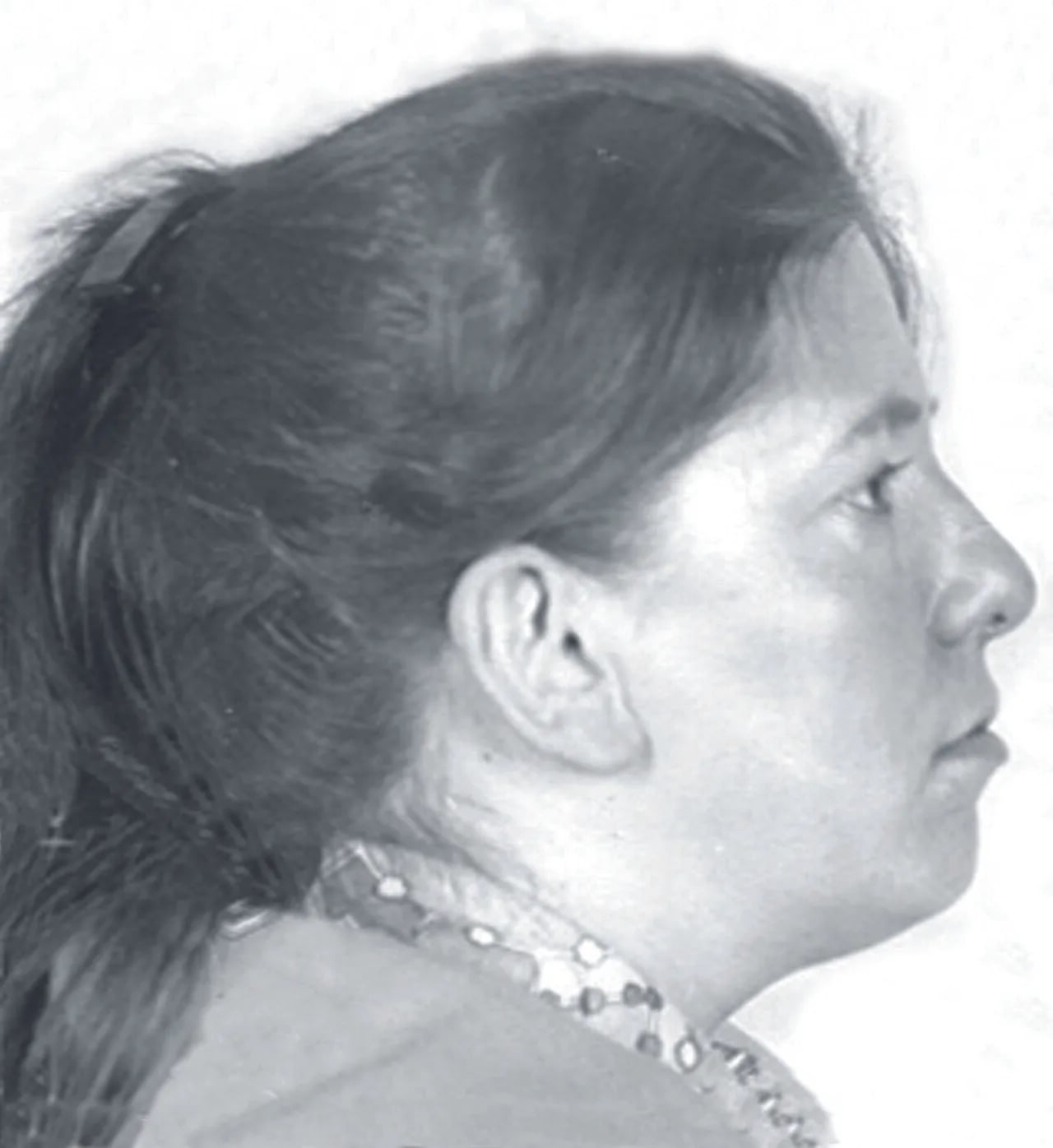 Porträt von Renée Pereira Gasagoite de Pelúa (1934–1976) – Gedenkseite