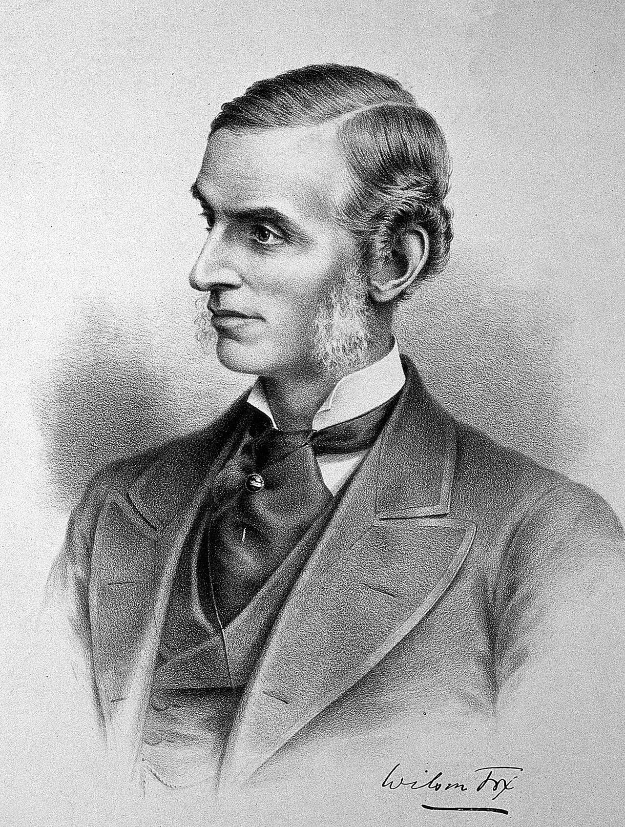 Portrait of Wilson Fox (1831–1887) – memorial page